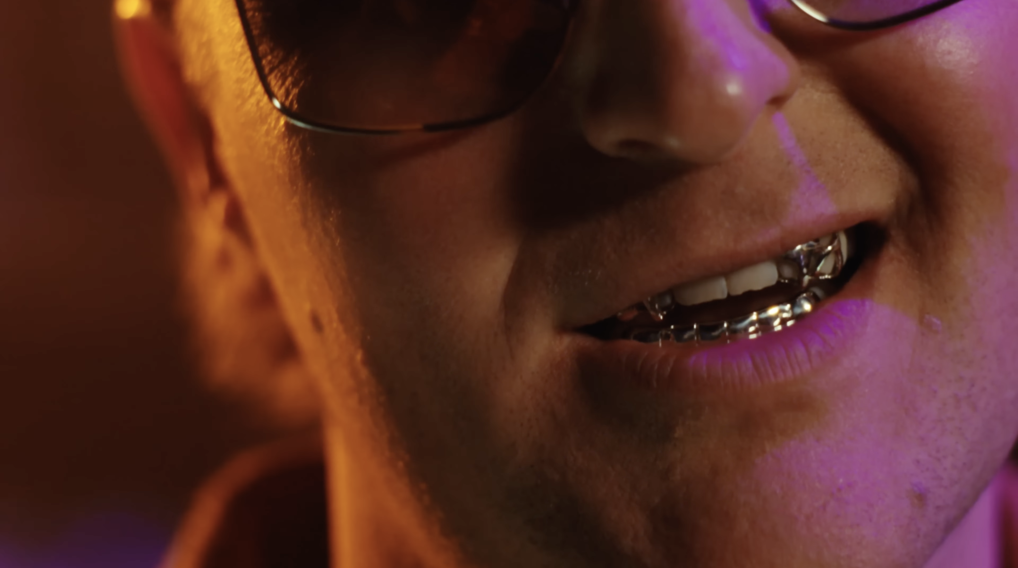 Custom Design Grillz Set – 4 Top with Back Bar & 6 Solid Bottom