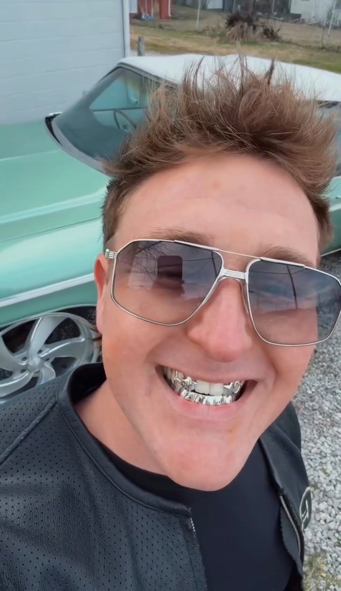 Custom Design Grillz Set – 4 Top with Back Bar & 6 Solid Bottom