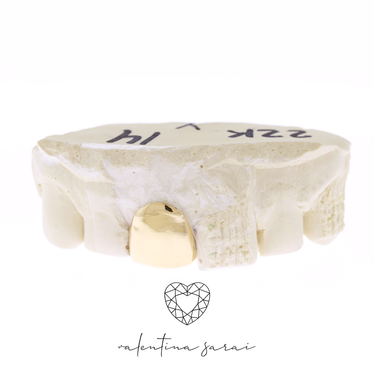 One Tooth Cap Grillz – Solid Custom Gold Grillz
