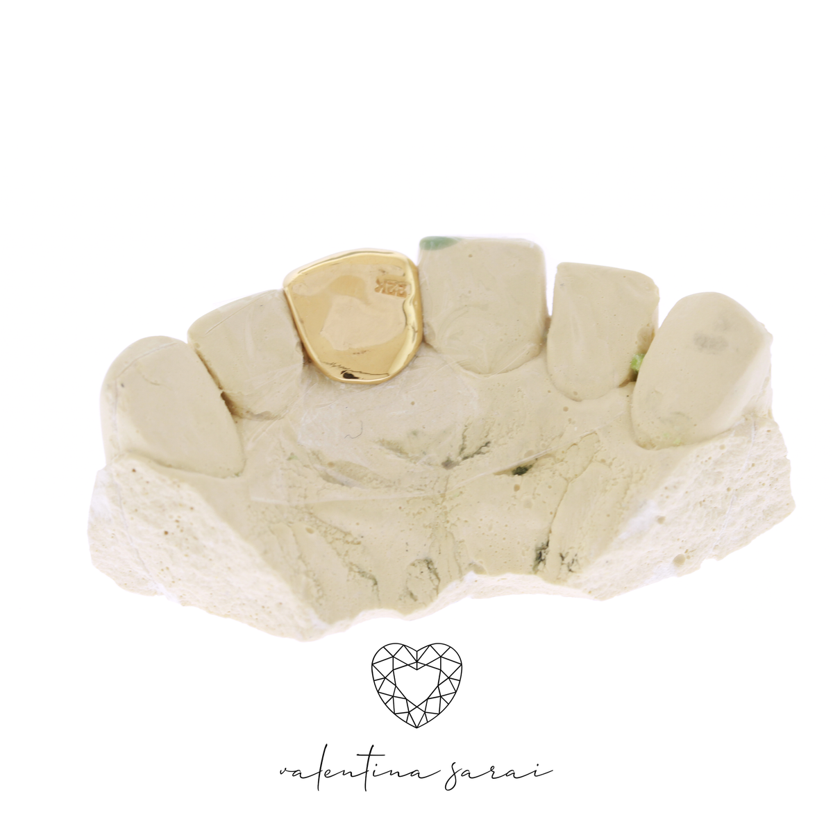 One Tooth Cap Grillz – Solid Custom Gold Grillz