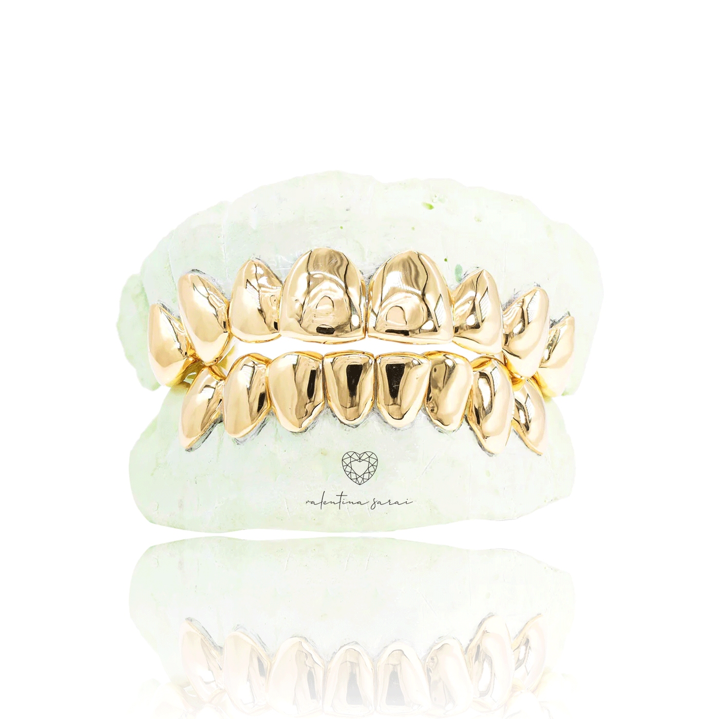 Custom Solid Gold Grillz